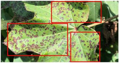 Advanced deep transfer learning techniques for efficient detection of cotton plant diseases